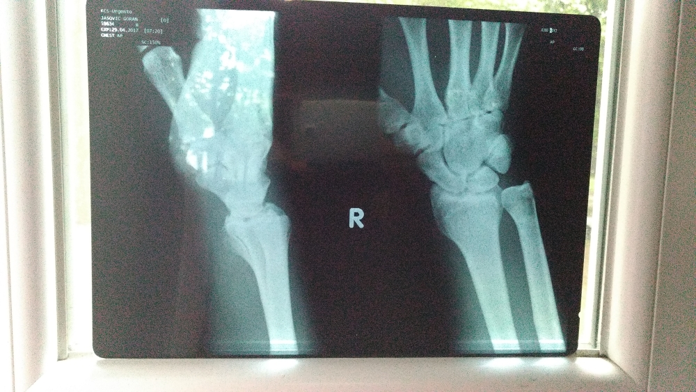 Leona X ray IMG_20170430_183643